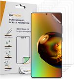 kwmobile 6x screenprotectors geschikt voor Samsung Galaxy S25 Ultra