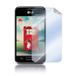 Celly SBF396 scherm- & rugbeschermer voor mobiele telefoons LG 2 stuk(s)