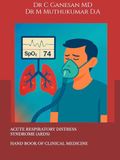 ACUTE RESPIRATORY DISTRESS SYNDROME - HAND BOOK OF CLINICAL MEDICINE