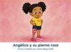 Angélica y su pierna rosa: Un cuento sobre las prótesis, el cuerpo propio y el orgullo de ser exactamente quien eres