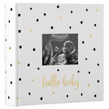 Pearhead Babyfotoalbum, babyboek aandenken voor nieuwe en aanstaande ouders, genderneutraal babyaccessoire, zwart en gouden stippen