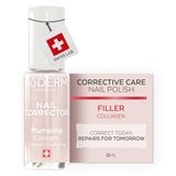 PODERM Nagelcorrector – Vulling | Professionele corrigerende behandeling | Onthult de natuurlijke schoonheid van je nagels
