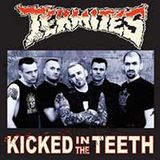 Sonic Rendezvous Termites - Kicked In The Teeth (LP)