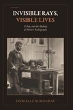 Invisible Rays, Visible Lives: X-Rays and the Making of Modern Radiography