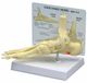 Icecat Model van voet- en enkelbotten, fasciitis plantaire