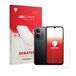 upscreen - Screenprotector voor Xiaomi Redmi 17C 5G (Voor+Camera) - Folie Beschermfolie transparant