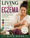 Living With Eczema: A Practical Everyday Guide