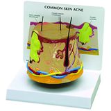 GPI Anatomicals 3750 huid model Acne