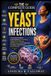 The Libri GmbH The Complete Guide to Yeast Infections
