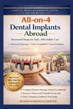 All The Responsible Planning- All on 4 Dental Implants in Mexico