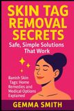 Skin Libri GmbH Skin Tag Removal Secrets: Safe, Simple Solutions That Work | The Skin Tag Solution: How to Remove Skin Tags Naturally & Effectively: Banish Skin Tags: Home Remedies and Medical Options Explained
