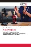 Acne vulgaris: Etiología, evaluación clínica, patofisiología, diagnóstico, tratamiento e impacto psicológico del acné