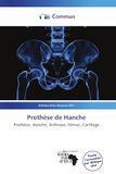 Prothèse OmniScriptum Prothèse de Hanche Paperback