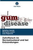 Zahnfleisch Verlag Unser Wissen Zahnfleisch im Normalzustand und bei Entzündungen Paperback