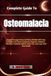 Complete Guide To Osteomalacia