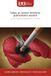 Tabac Tabac et cancer broncho-pulmonaire avancé: le poids invisible de la dépendance nicotinique