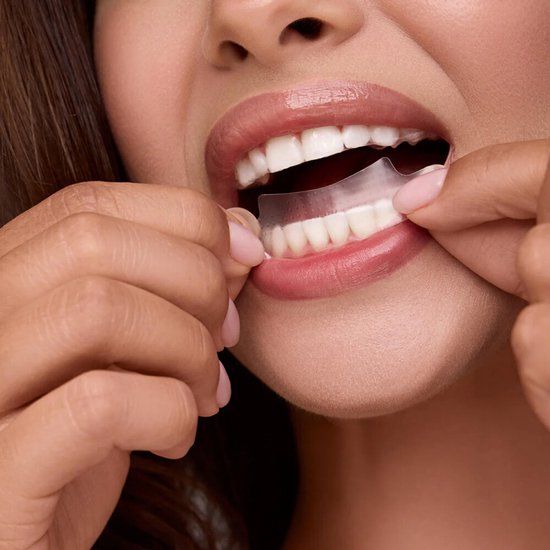 Clearsmile Whitening Strips PAP+ Transparant - Raspberry