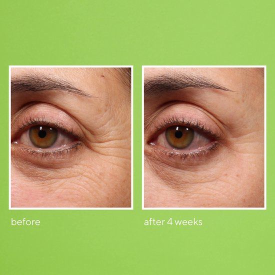 Murad Retinol Youth Renewal Eye Serum - 15 ml - Voor alle huidtypen