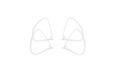 DJI Protège-hélices pour Phantom 4