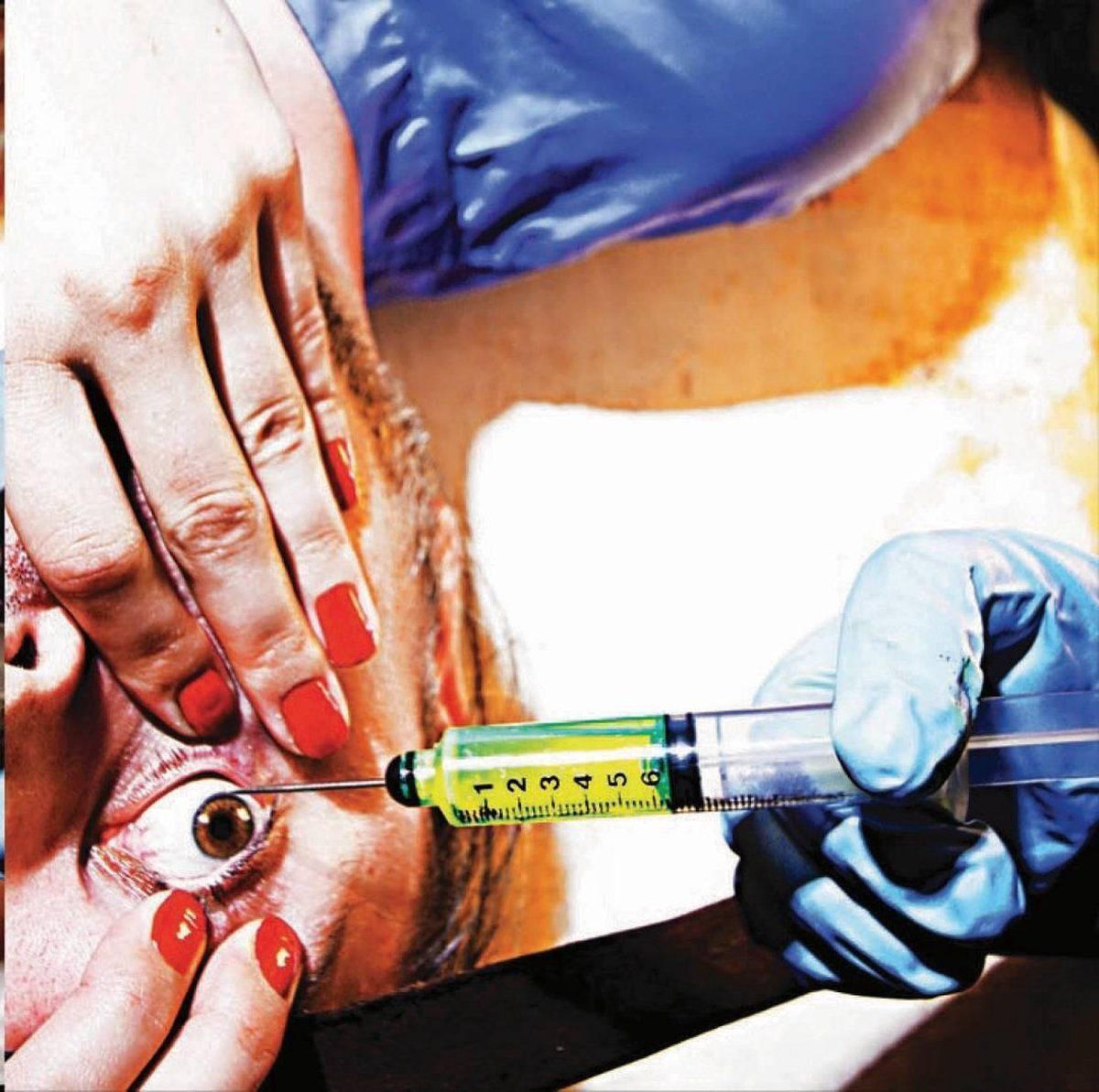 Konkurrent Acid Or Blood - 0718752814225