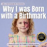 Why Boonhouse Publishing The Whole Brain Toddler- Why I was Born with a Birthmark