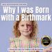 Why Boonhouse Publishing The Whole Brain Toddler- Why I was Born with a Birthmark