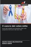 Il OmniScriptum SRL Il cancro del colon-retto Paperback