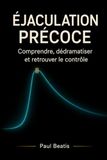 ÉJACULATION PRÉCOCE: Comprendre, dédramatiser et retrouver le contrôle