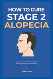 How Icecat How To Cure Stage 2 Alopecia: A Holistic Guide to Stop Hair Loss, Reduce Inflammation, and Regrow Your Hair with Proven Treatments, Diet, and Stress Management