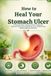 How to Heal Your Stomach Ulcer: A Practical Guide to Relieving Pain, Healing the Stomach Lining, Preventing Recurrence, and Restoring Healthy Digestion Naturally