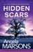 Hidden Bookouture Detective Kim Stone - Hidden Scars