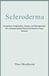 SCLERODERMA: Symptoms, Progression, Causes, and Management of a Complex Autoimmune Connective Tissue Disease