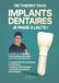 Implants dentaires : je passe à l'acte !