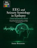 EEG and Seizure Semiology in Epilepsy Clinical Interpretation Manual
