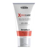 Synergy Therm Xerocare Dermatologe Anti-Calycitis Creme mit 40% Harnstoff, 50 ml, Synergy Therm
