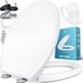 Kesser abattant de WC avec fermeture douce - Abattant de WC avec Duroplast et fonction de libération rapide - Blanc / Forme O