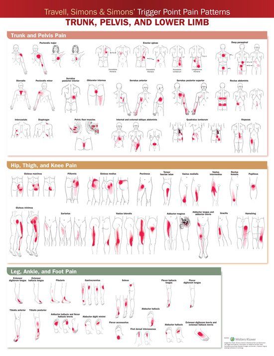 Travell, Simons & Simons’ Trigger Point Pain Patterns Wall Chart - Trunk, Pelvis, and lower limb