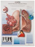3B Scientific schoolbord CHRONISCH obstructieve longsinfectie, unlaminated