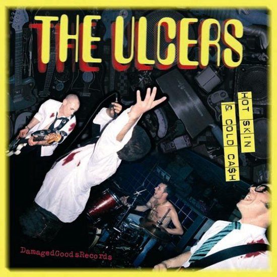 Hot Ulcers Hot Skin & Cold Cash