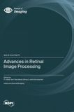 Advances Libri GmbH Advances in Retinal Image Processing Hardcover