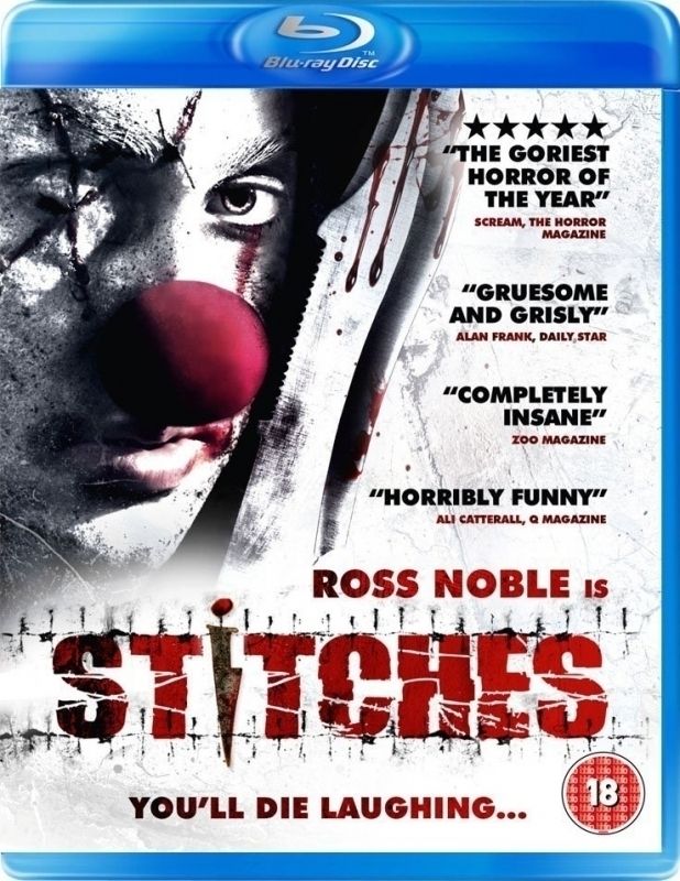 Stitches