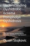 Understanding Icecat Understanding Dyshidrotic Eczema Pompholyx Dyshidrosis: Why Your Immune System Lost Its Tolerance—And How to Help Restore It