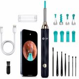 BP® Oorsmeer Verwijderaar met Camera - Oorreiniger - Ear Cleaner - Oor Schoonmaken - Earscratcher - Oorlepel - Inclusief Reinigingsset - USB Oplaadbaar - Met App