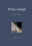 Peau-rouge BoD - Books on Demand Peau-rouge Paperback