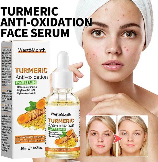 Merkloos / Sans marque Kurkuma Olie Serum - Anti Aging, Vermindert Huidveroudering, Vlekken & Acne - 30mg