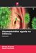 Otomastoidite OmniScriptum SRL Otomastoidite aguda na infância Paperback