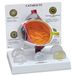GPI Anatomicals W47852 oogmodel Katarackt, grijze ster